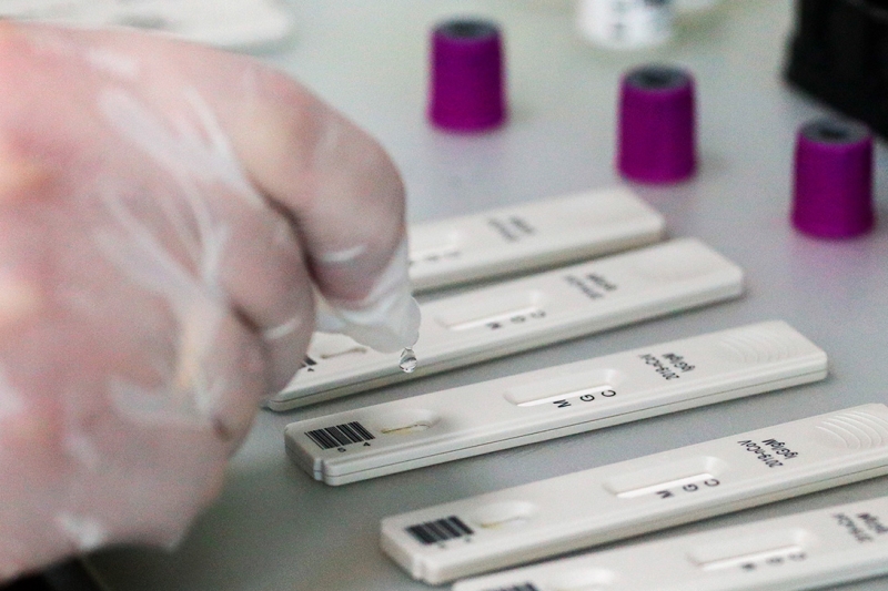 COVID-19 в Беларуси, экспресс-тесты на антитела к коронавирусу - фото